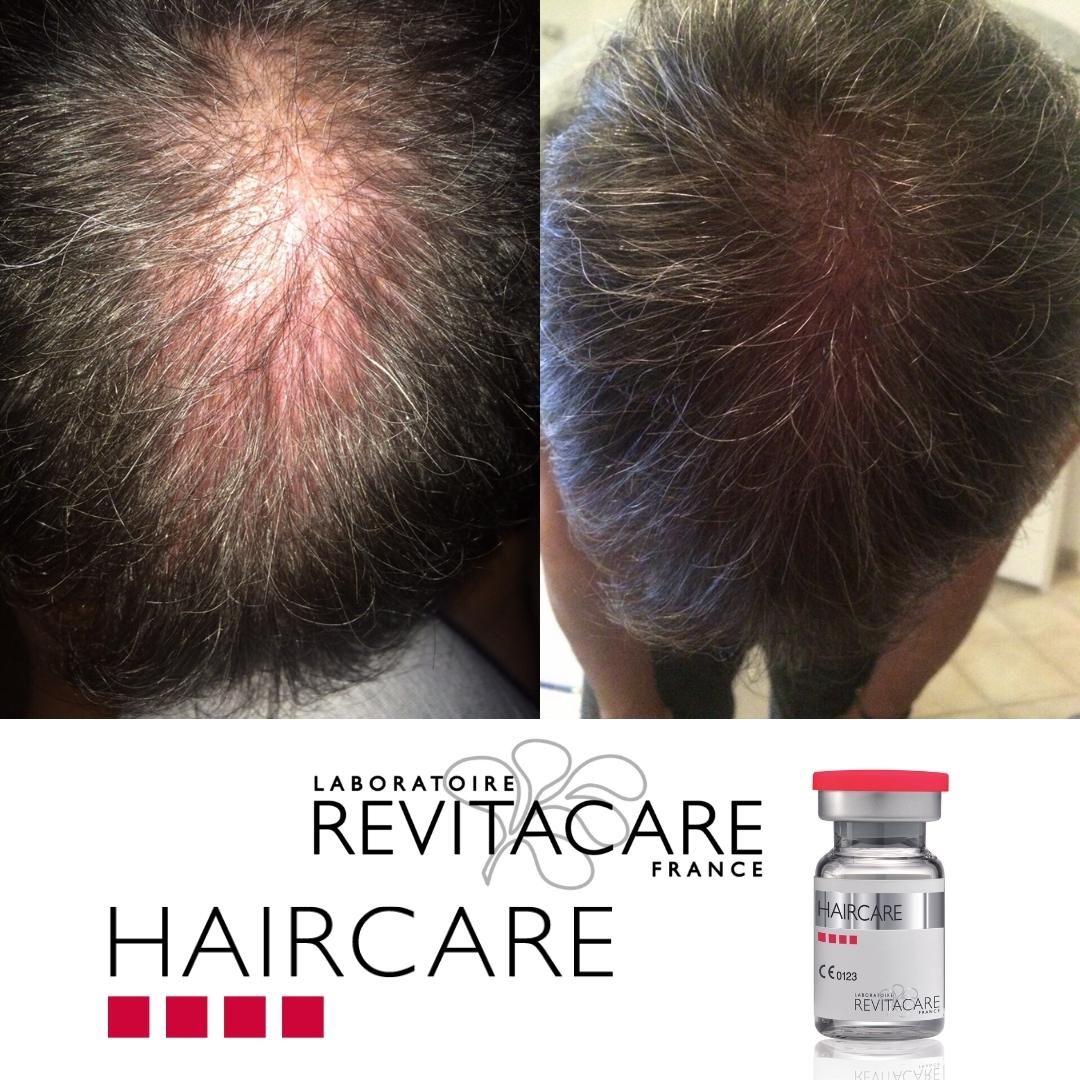 Revitacare Haircare - Image 5