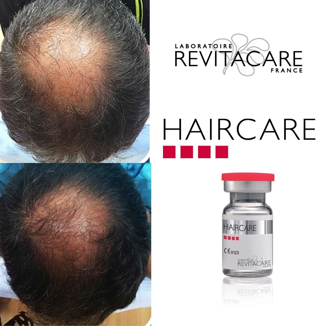 Revitacare Haircare - Image 4