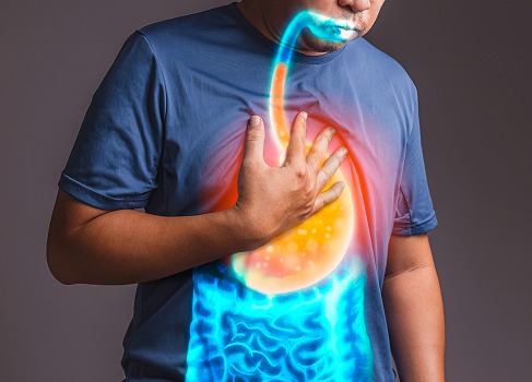 Acid Reflux